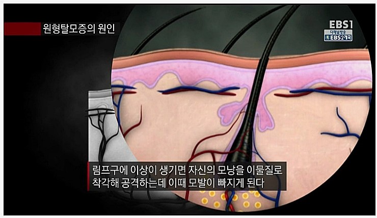 이미지입니다.